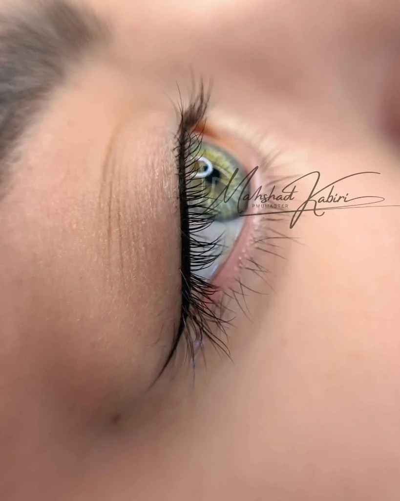 خدمات خط چشم تخصصی